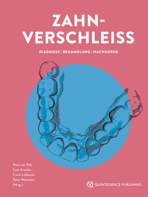 cover image of Zahnverschleiß